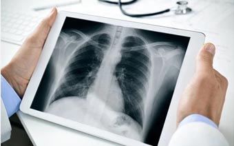 Digital X-ray