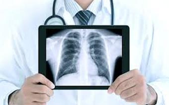 Digital X-ray