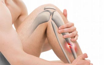 Fractures & Trauma Surgeries