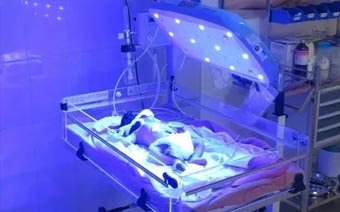 phototherapy
